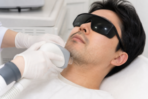 수염 레이저 제모 상담 질문